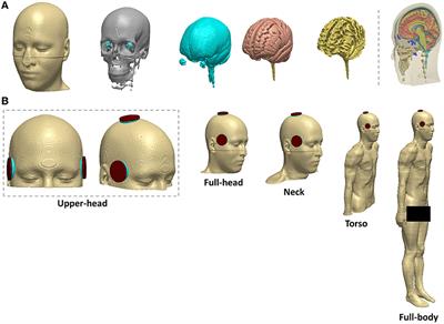 Impact of modeled field of view in electroconvulsive therapy current flow simulations